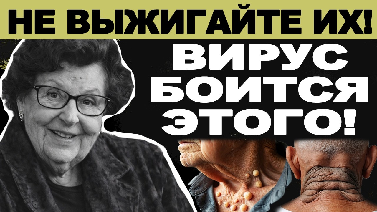 Папилломы отсохнут до корня за 5 дней! Главный враг вируса, который есть на вашей кухне.