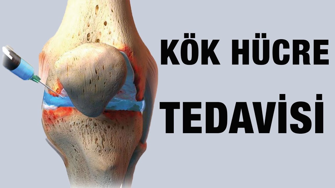 Kök Hücre Tedavisi YouTube Kök Hücre Tedavisi YouTube