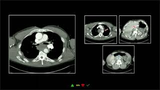 Thoracoabdominal Trauma Part 1 | Free Radiology CME screenshot 1