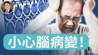 暴躁、健忘也許不是老了，是腦在發炎？CTE腦部慢性發炎真相解析｜四維健康