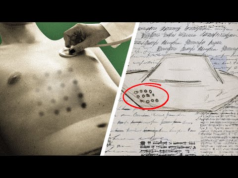 Video: UFO-hendelse Og øyenvitne Strålesyke I Falcon Lake - Alternativ Visning