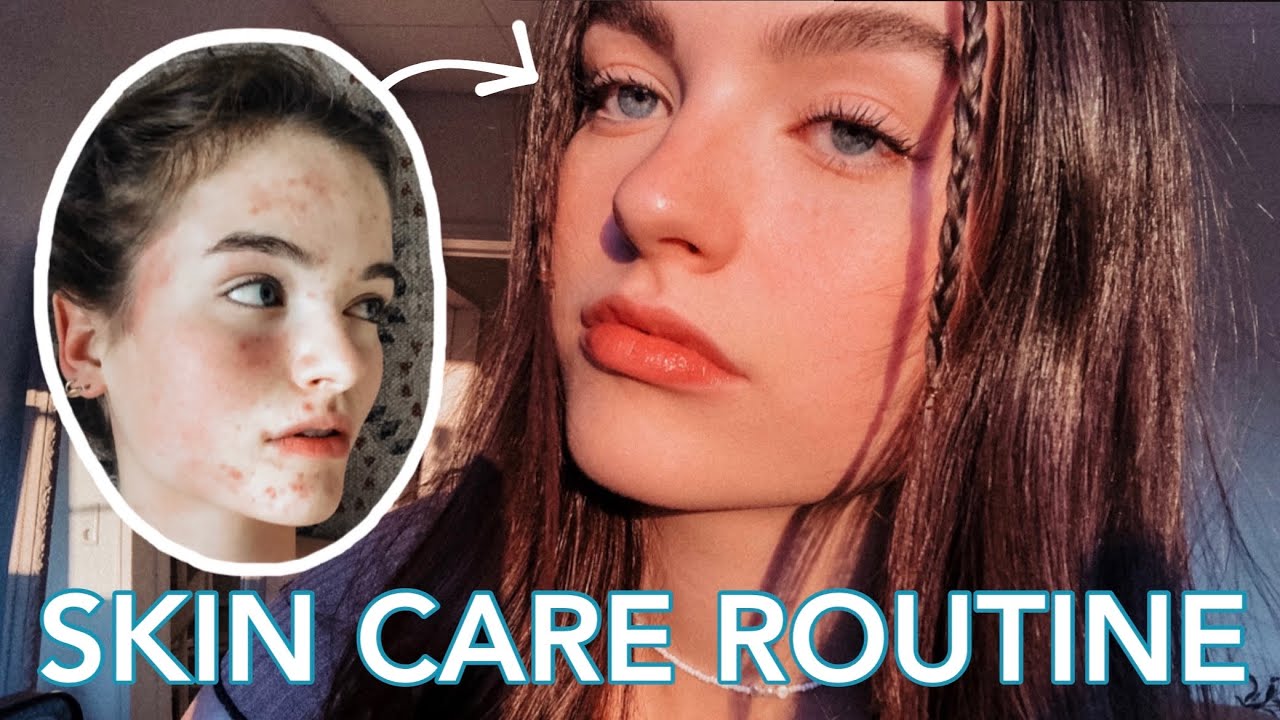 Update Meine ✨SKIN CARE✨ Routine (Akne geheilt) | Fabienne Bethmann