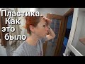 Швы после блефаропластики🤔 Как прошла операция по коррекции век😉 эпизод 95, 12.12.2020