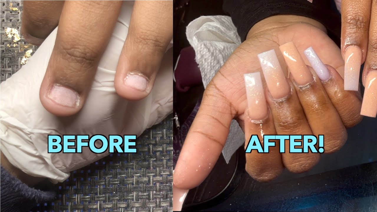 Nail bed progress. Nails are of the same length in both. Our nail beds do  attach and grow. We can do this : r/nailbiting