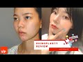 Rhinoplasty review vip plastic surgery   vip