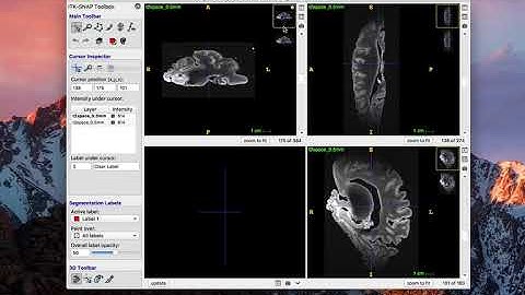 ITK-SNAP rotating a dicom "in-place"