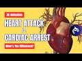 Cardiac Arrest vs Heart Attacks - What