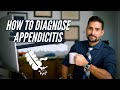 How to Diagnose Appendicitis