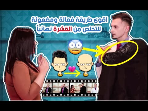 فيديو: كيفية إزالة القشرة من رأسك