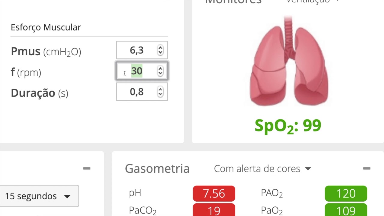 Fisiologia Respiratória: Ventilação, PaCO2 e pH - Parte 3