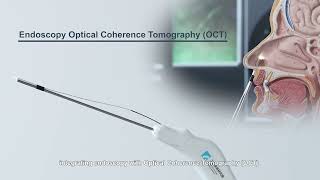 Multimodal Intranasal OCT System