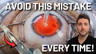 Watch This "Pearl" Before Performing Your Next Surgery: The Trailing Haptic Trap