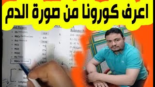 صوره الدم وتحاليل كورونا وازاي تعرف الاصابه بكورونا من صورة الدم في المنزل