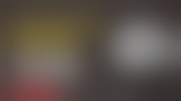 Zygomatic Implants Courses India | Zygomatic Pterygoids Implants Courses India | Zygomatic Implants