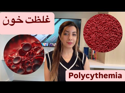 غلظت خون علت علائم درمان پلی سیتمی 