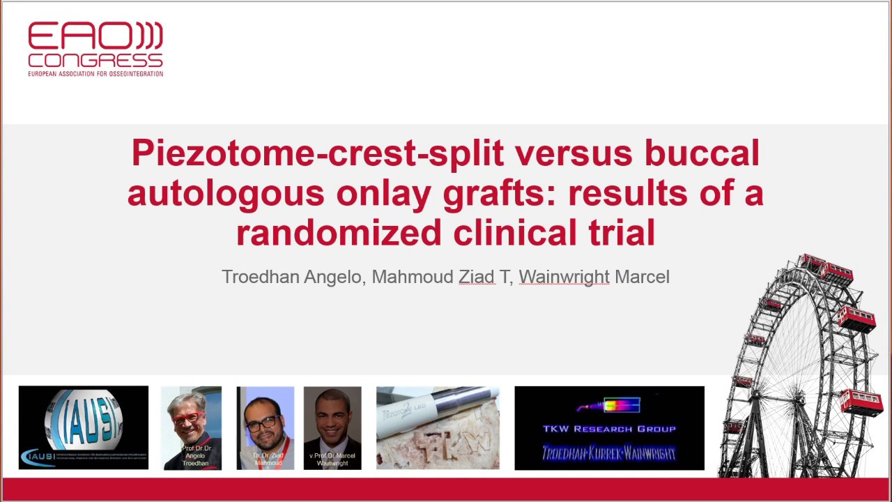 Flapless Piezotome Crest Split vs. Onlay grafting RCT / Ultraschall Kieferknochenaufbau