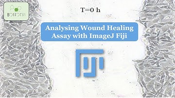 Unlock the Secrets of Wound Healing: Learn How to Analyze Scratch Assays with ImageJ