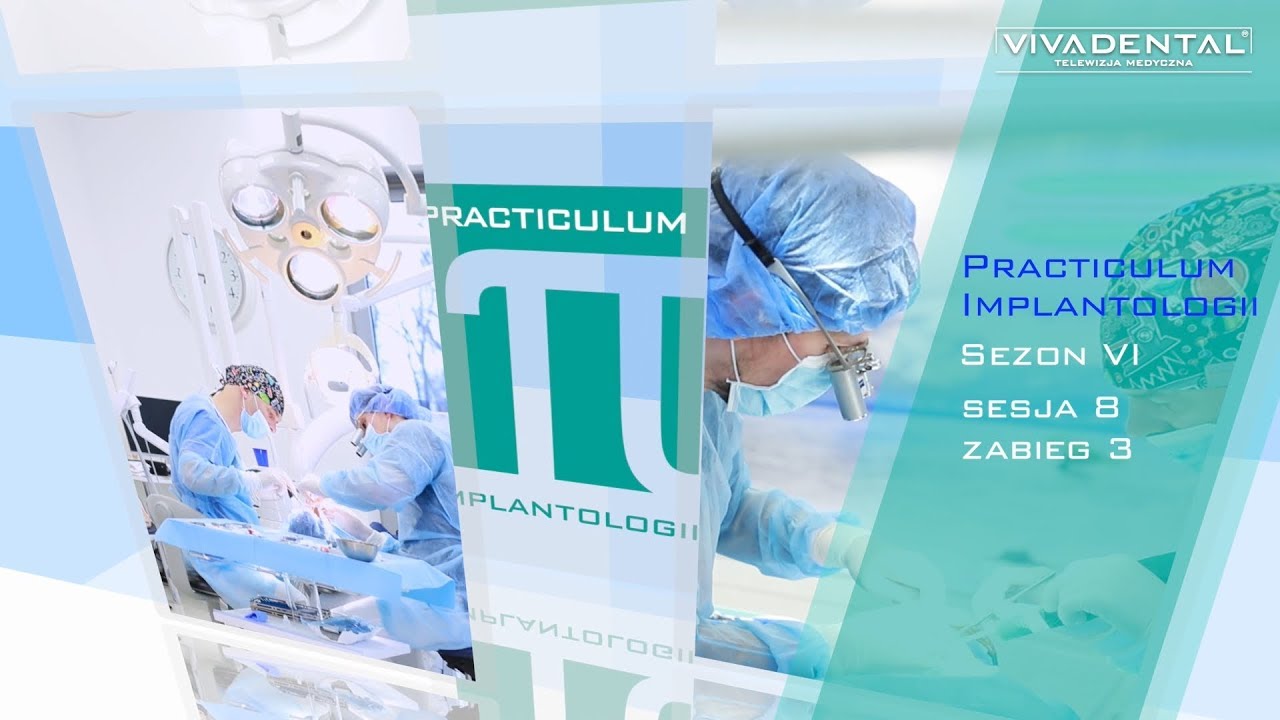 PRACTICULUM IMPLANTOLOGII SEZON VI SESJA 8 ZABIEG 3