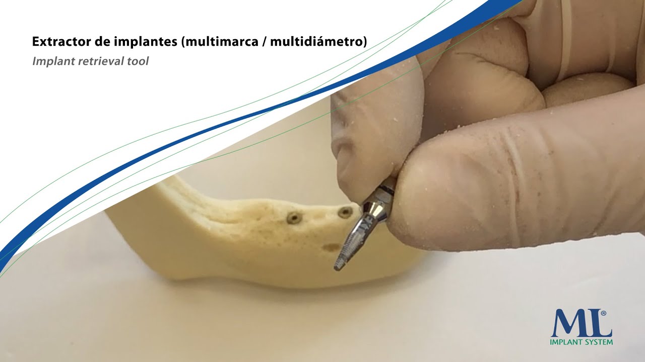 Extractor de implantes ML | Implant retrieval