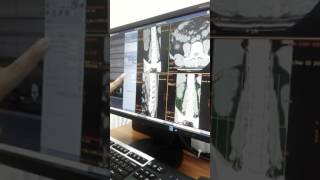 How To Mak Image Fr Scan