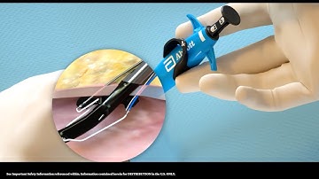 US Perclose ProStyle Single Device Deployment Animation