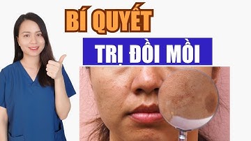 Tiết lộ 3 cách trị đồi mồi ở mặt, ở tay nhanh chóng nhất, cách để không bị đồi mồi| Nguyễn Mai Hương