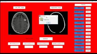 SVM Classifiers MATLAB PROJECTS