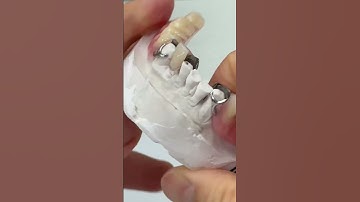 Terrific Titanium partial!