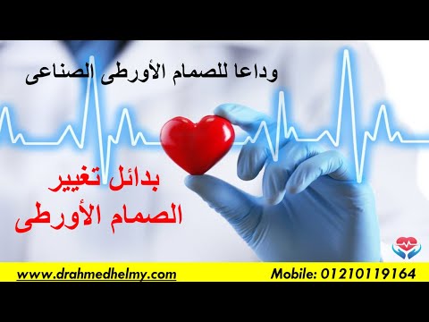 بدائل تغيير الصمام الأورطى هل يمكن الاستغناء عن الصمام الأوررطى الصناعى