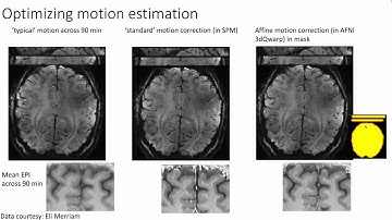 Renzo Huber: Ultra high resolution fMRI in the presence of motion