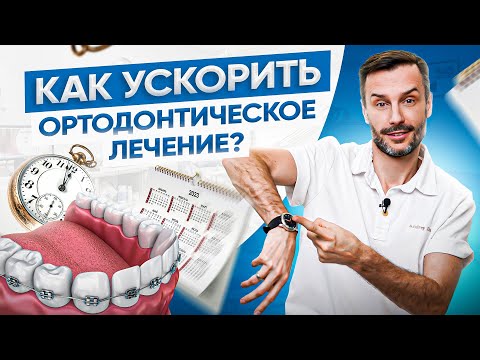 Как ускорить ортодонтическое