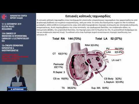 Δ. Ιατρόπουλος  | 01. ΑΕΝΑΗ ΚΟΛΠΙΚΗ ΤΑΧΥΚΑΡΔΙΑ ΑΠΟ ΤΟ ΩΤΙΟ ΤΟΥ ΑΡΙΣΤΕΡΟΥ ΚΟΛΠΟΥ