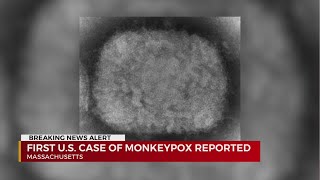 First US case of monkeypox reported