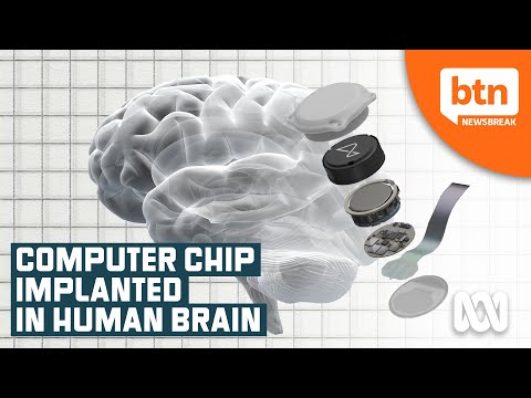 Neuralink's Computer Chip Brain Implant