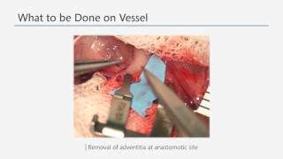 삼성서울병원 Advanced training on microsurgery 1[Micro] screenshot 5