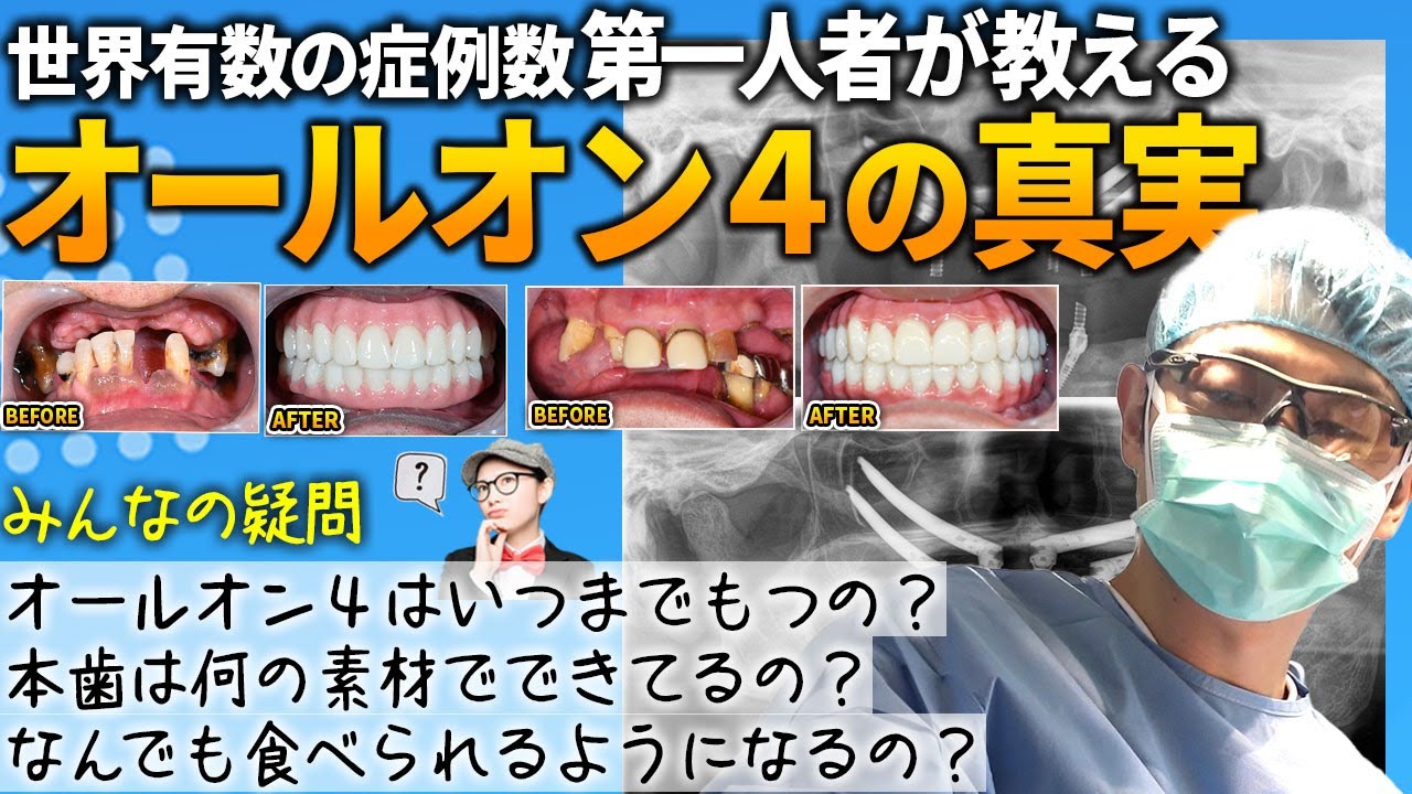 【緊急企画】オールオン4について普段聞けないこと全部聞きました！果たして第一人者ナルト先生の回答は？他の医師とは明らかに違う！緊急企画シリーズ