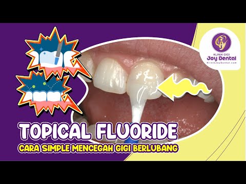 Video: Apakah stannous fluoride memperkuat gigi?