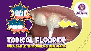Topical Fluoride Cara Paling Simple Mencegah Gigi Berlubang