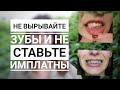 Не выравайте зубы❌ Не ставьте импланты❌ НЕ ПОСМОТРЕВ ЭТО ВИДЕО✔! Брекеты! До и После.