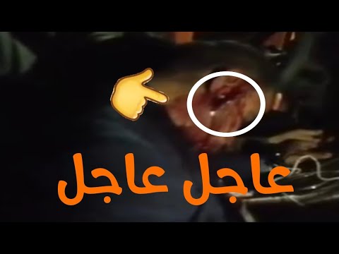 لحضه قتل الشهيد المراسل احمد عبد الصمد اخر فيديو اله الله يرحمة