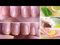 Как укрепить ногти при помощи растительного масла