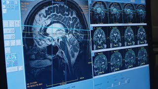 Download Lagu Focused Ultrasound: Treating Essential Tremor and Movement Disorders at Penn Medicine MP3