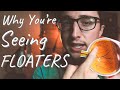 Eye Surgeon Explains Why You're Seeing Spots in Your Eyes! | Visual Floaters and Vitreous Detachment