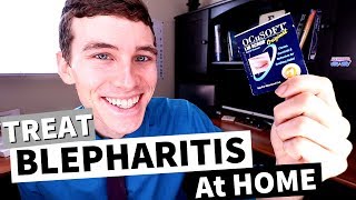 What is Blepharitis? (How to Treat Blepharitis at Home)
