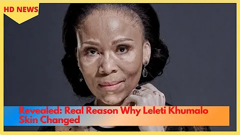 Revealed: Real Reason Why Leleti Khumalo Skin Changed