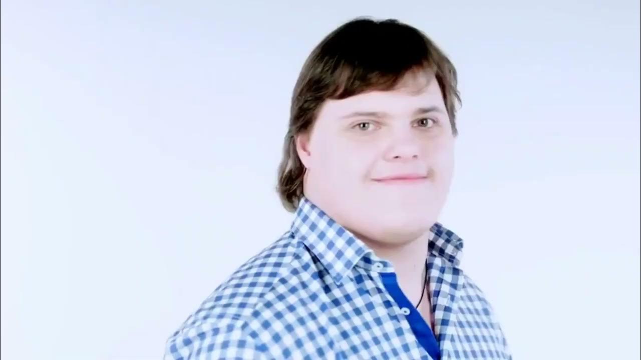 люди дауны. мальчик с синдромом дауна. синдром дауна трисомия 21. синдром дауна трисомия 21 хромосомы. синдром дауна трисомия по 21.