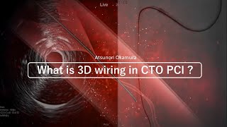ใEnglishใ What is 3D wiring in CTO PCI