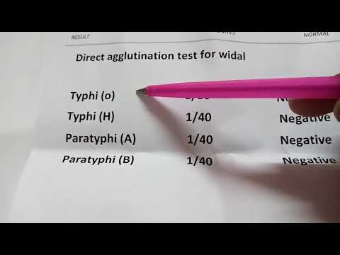 فيديو: كيف تفسر اختبار widal؟