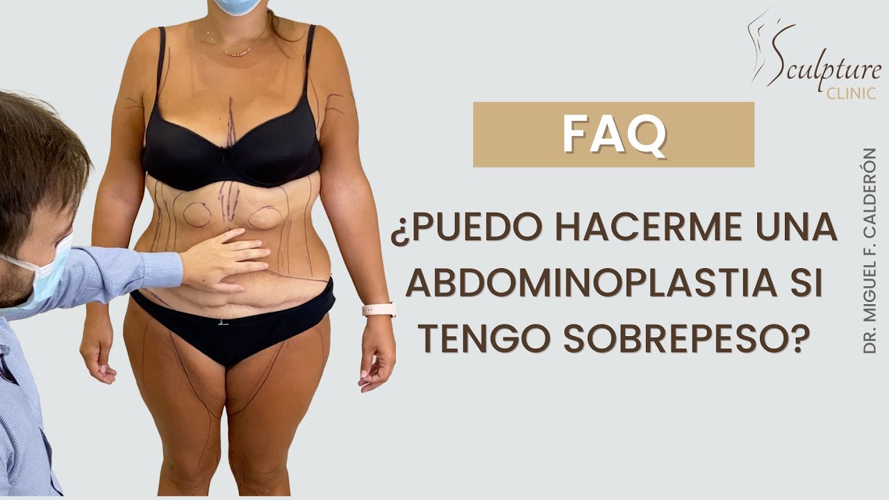 6.- Abdominoplastia: ¿Una persona con sobrepeso se puede realizársela?