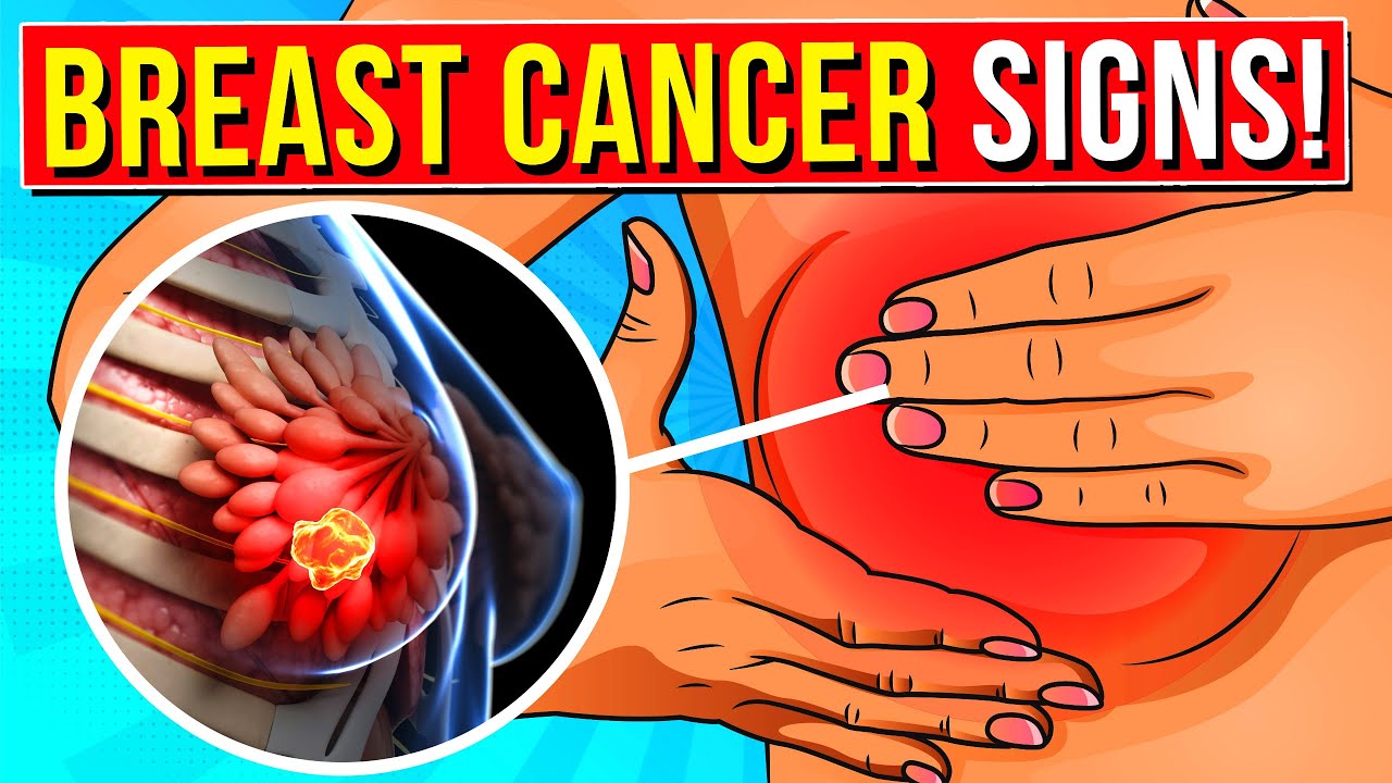 Early warning signs of breast cancer women need to know youtube